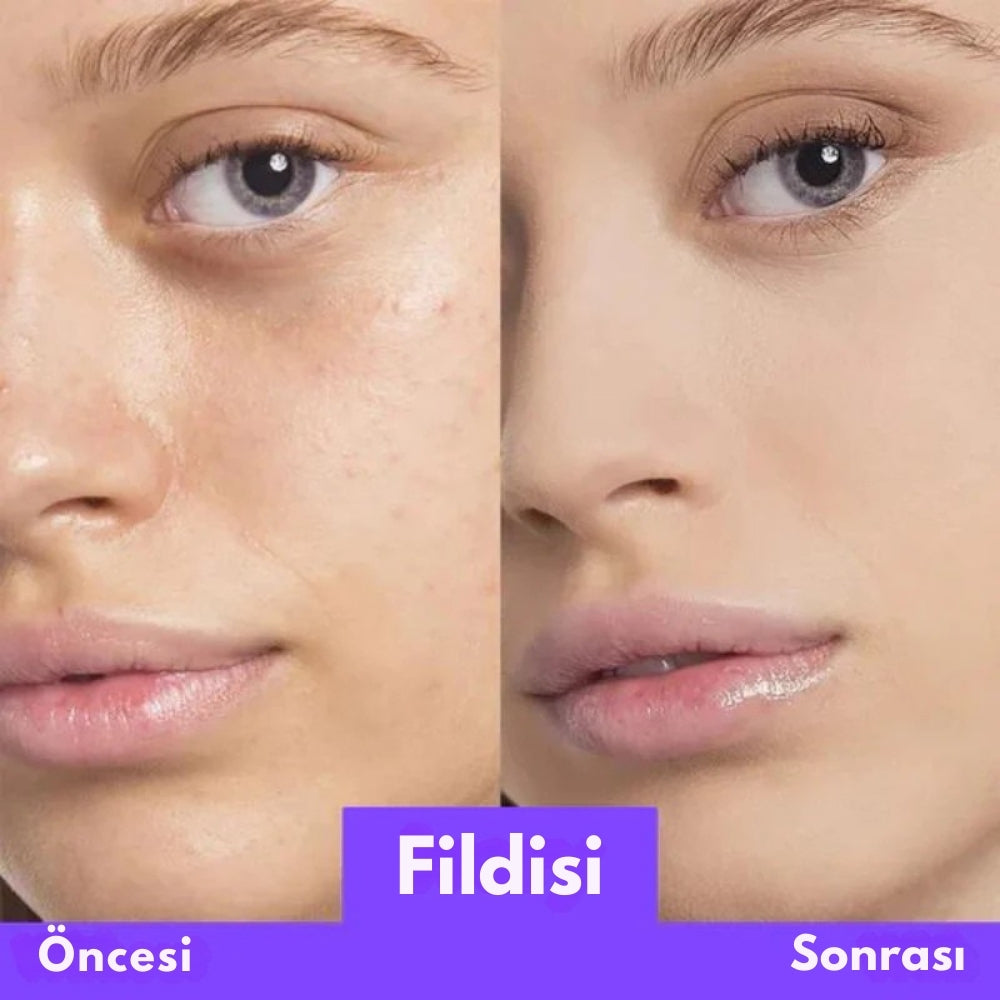 Skinvera İksir+ Krem